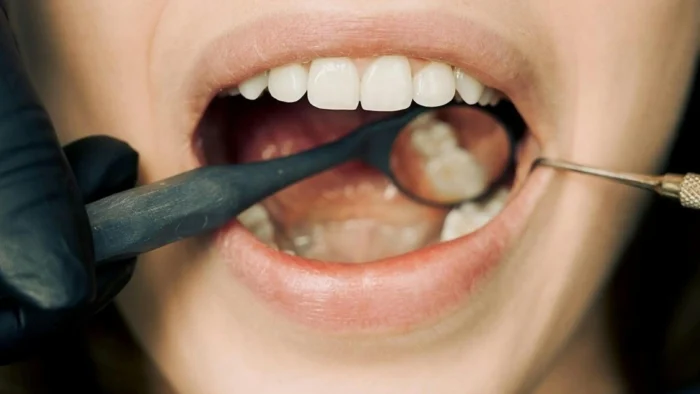 Dentist examining person's teeth for home straightening options